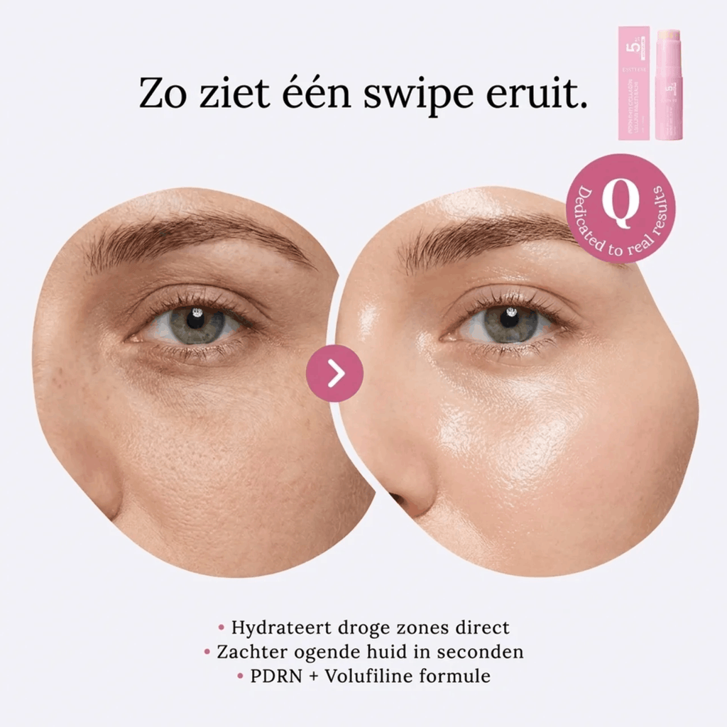 Korean PDRN Balm Stick - Frisser, zachter, voller — op de plekken waar je huid je leeftijd verraadt.